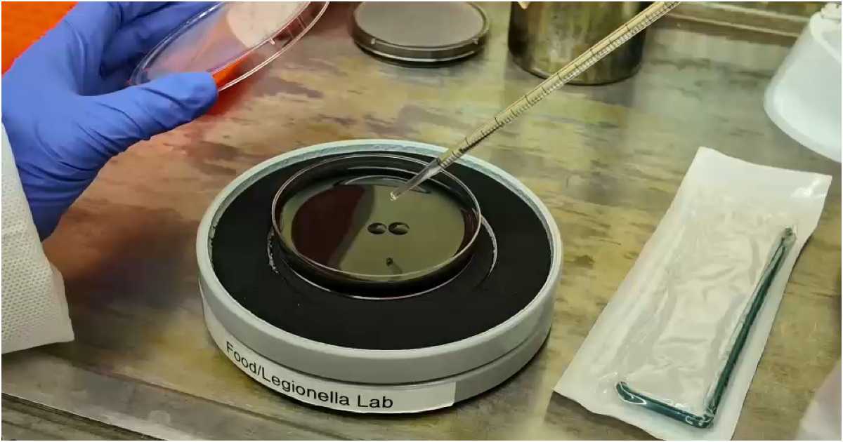 লিজনেয়ার্স রোগ নিয়ে পরীক্ষা-নিরীক্ষা। ছবি: আইউইটনেস নিউজ